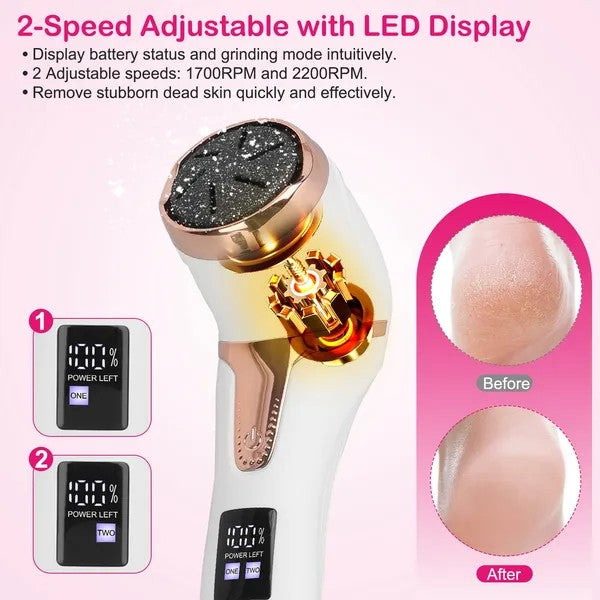 Electric Foot Callus Remover - Professional Rechargeable Pedicure Tool (17Pcs Set)