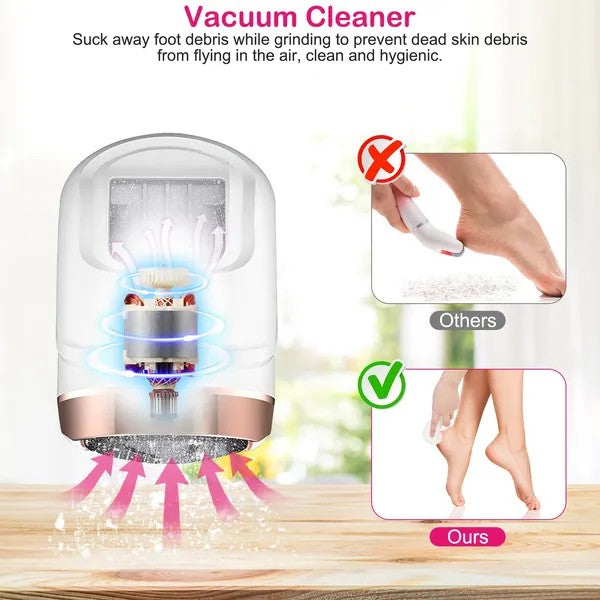 Electric Foot Callus Remover - Professional Rechargeable Pedicure Tool (17Pcs Set)